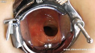 Incredible deep anal view with XO speculum and light in Hotkinkyjo ass