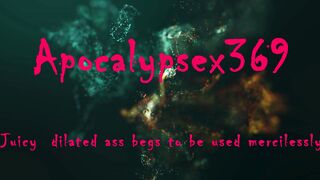 Anal Expansion and Intense Use